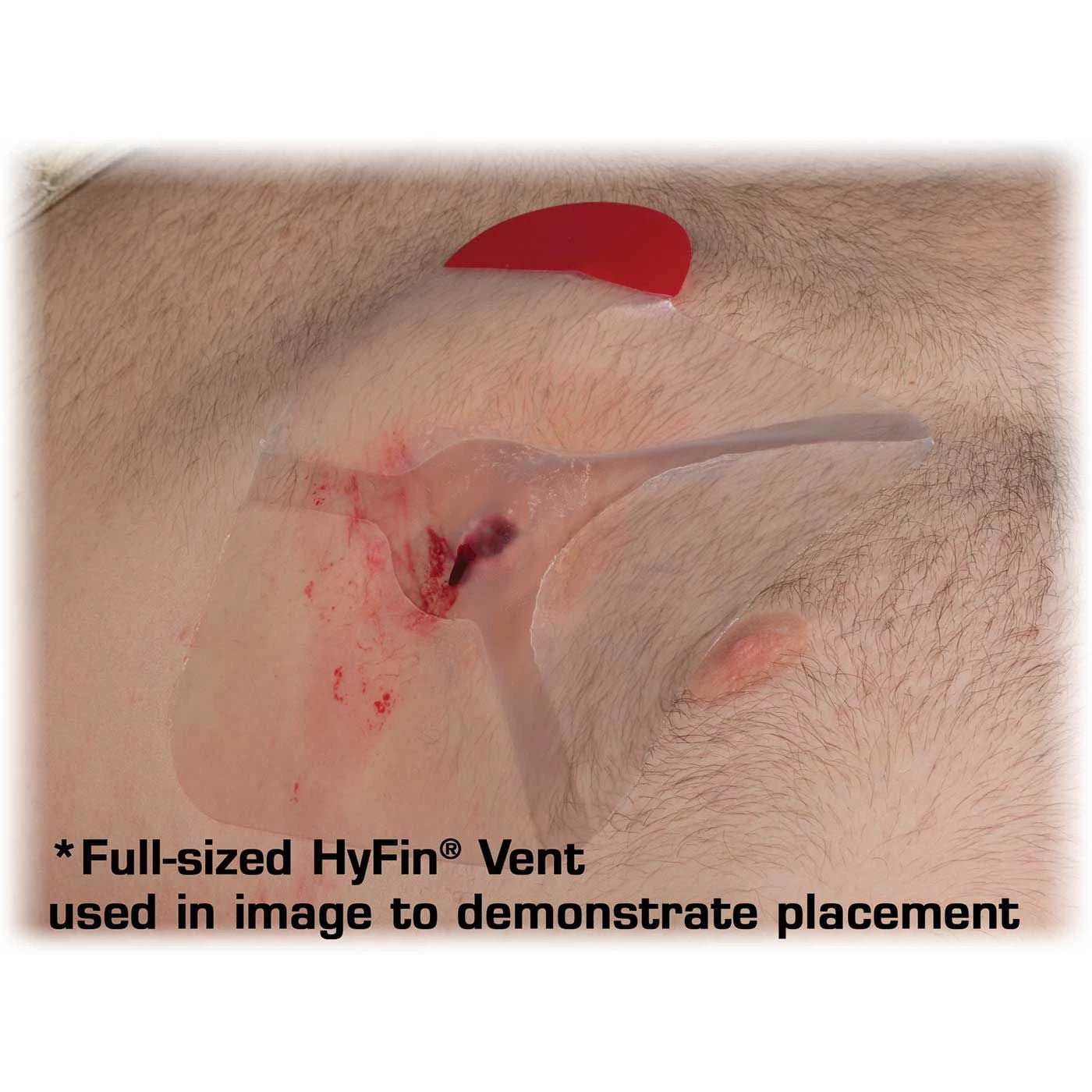 HyFin® Vent Chest Seal Twin Pack by North American Rescue – Advanced 3-Vent Trauma Seals for Tactical & Emergency Use