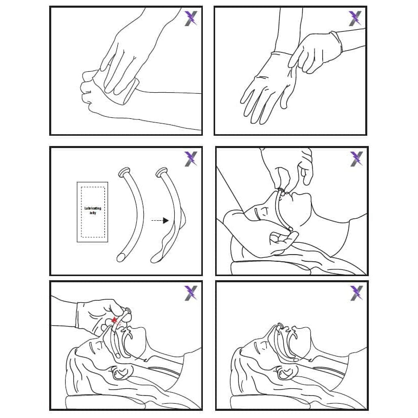 Lightning X NPA Kit – Complete Nasopharyngeal Airway Set with Lube & C ...